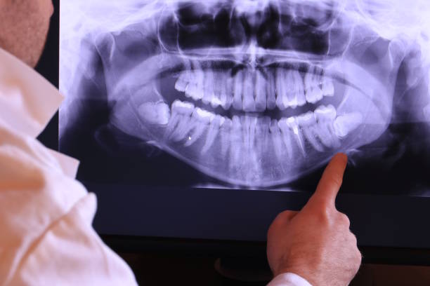 Best Emergency Root Canal Treatment in Quinnesec, MI