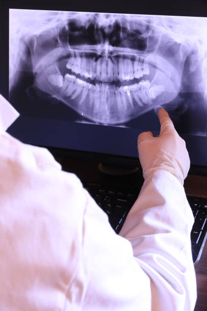 Best Emergency Dental Extractions in Quinnesec, MI