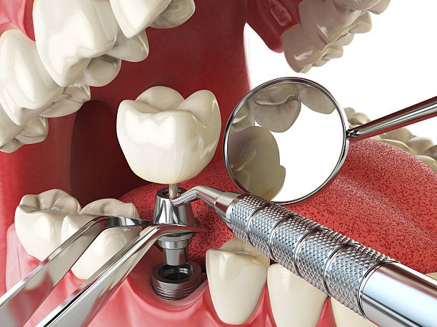 Best Emergency Dental Services for Seniors in Quinnesec, MI